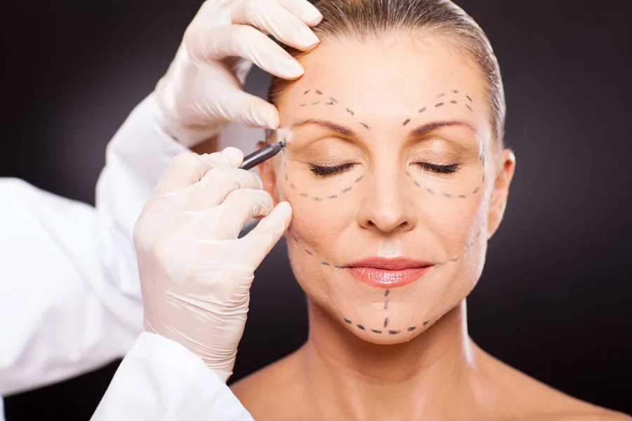 Chirurgie esthétique du visage — Dr Ahlam Bellaouchi, ORL Oulfa Casablanca